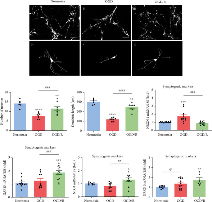 Growth Hormone (GH) Enhances Endogenous Mechanisms of Neuroprotection and Neuroplasticity after Oxygen and Glucose Deprivation Injury (OGD) and Reoxygenation (OGD/R) in Chicken Hippocampal Cell Cultures.