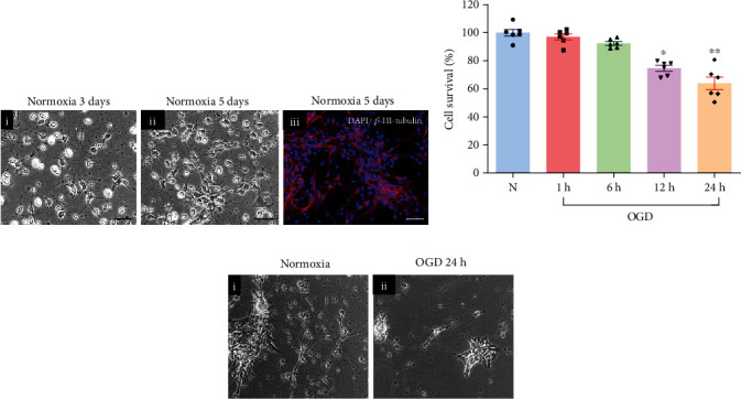 Growth Hormone (GH) Enhances Endogenous Mechanisms of Neuroprotection and Neuroplasticity after Oxygen and Glucose Deprivation Injury (OGD) and Reoxygenation (OGD/R) in Chicken Hippocampal Cell Cultures.