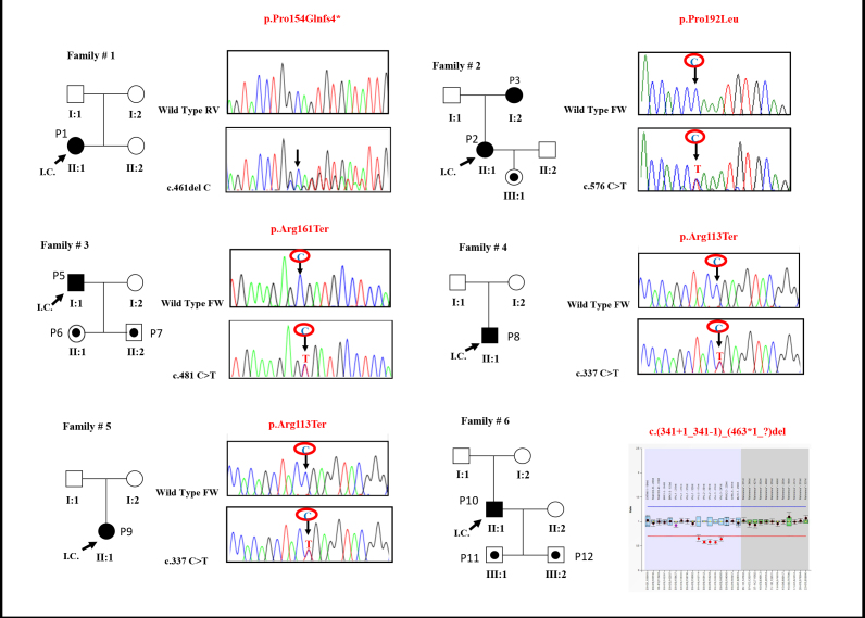 Outcome and genetic analysis of patients affected by retinal capillary hemangioblastoma in von Hippel Lindau syndrome.