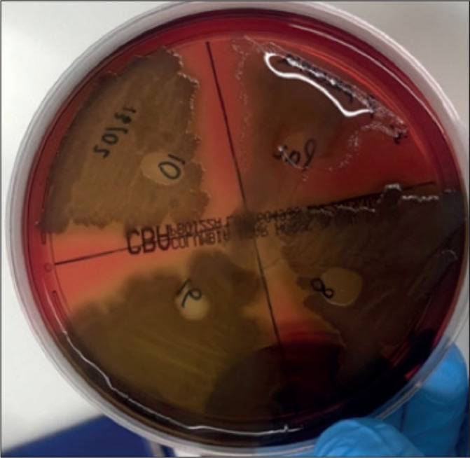 Discovery of inhibition of <i>Burkholderia cenocepacia, Pseudomonas aeruginosa</i> and <i>Stenotrophomonas maltophilia</i> by the Brown Rot Basidiomycete Fungus, <i>Postia placenta</i>.