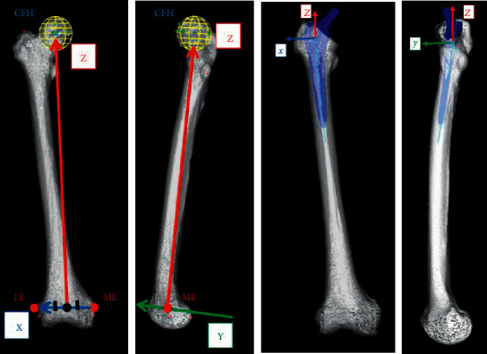 Interobserver and Intraobserver Reliabilities of Three-Dimensional Postoperative Evaluation Software in Total Hip Arthroplasty.