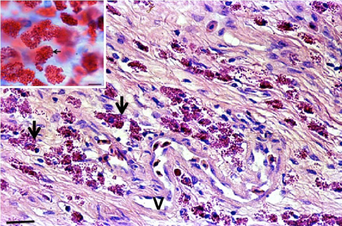 Mast cells and eosinophilic granule cells in Oncorhynchus mykiss: Are they similar or different?