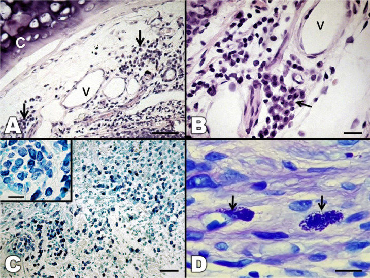 Mast cells and eosinophilic granule cells in Oncorhynchus mykiss: Are they similar or different?