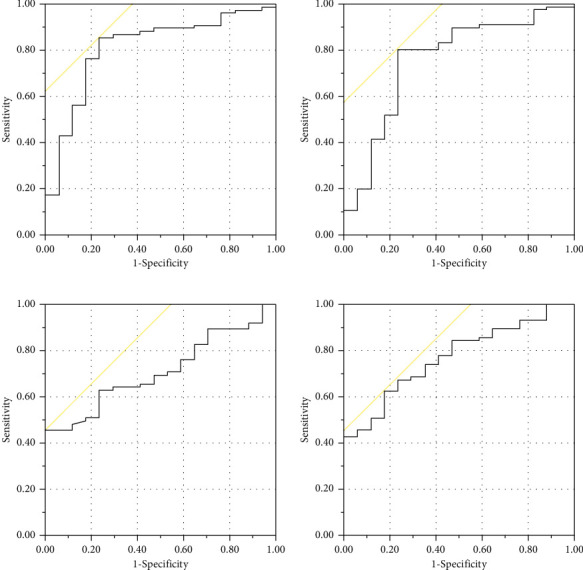 Association of Postoperative Neutrophil Lymphocyte Ratio (NLR) and Monocyte Lymphocyte Ratio (MLR) with the Presence of Osteoporosis in Japanese Patients after Hip Fracture Surgery: A Retrospective Cohort Study.