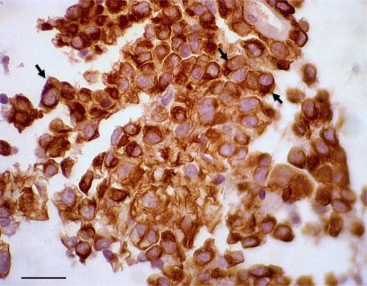 Mast cells and eosinophilic granule cells in Oncorhynchus mykiss: Are they similar or different?