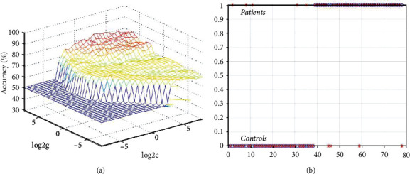 Altered Functional Connectivity Strength at Rest in Medication-Free Obsessive-Compulsive Disorder.