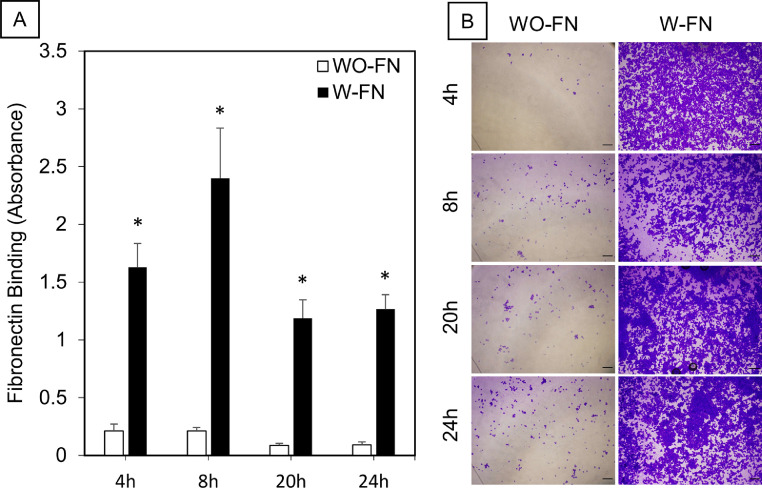 Polymeric siRNA delivery targeting integrin-β1 could reduce interactions of leukemic cells with bone marrow microenvironment