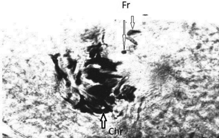 Study of chromatin diminution in <i>Cyclopskolensis</i> (Copepoda, Crustacea) by radiobiological methods.