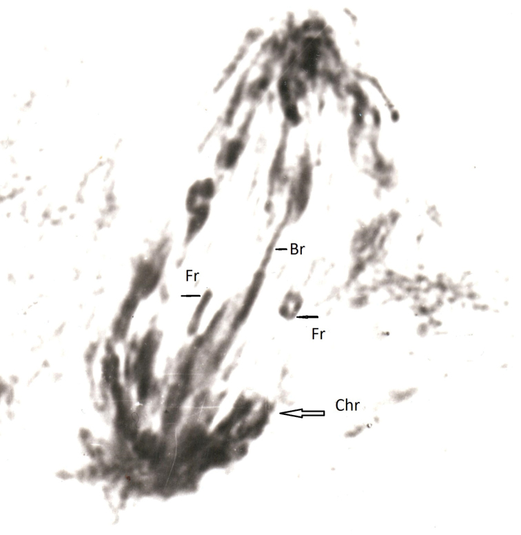 Study of chromatin diminution in <i>Cyclopskolensis</i> (Copepoda, Crustacea) by radiobiological methods.