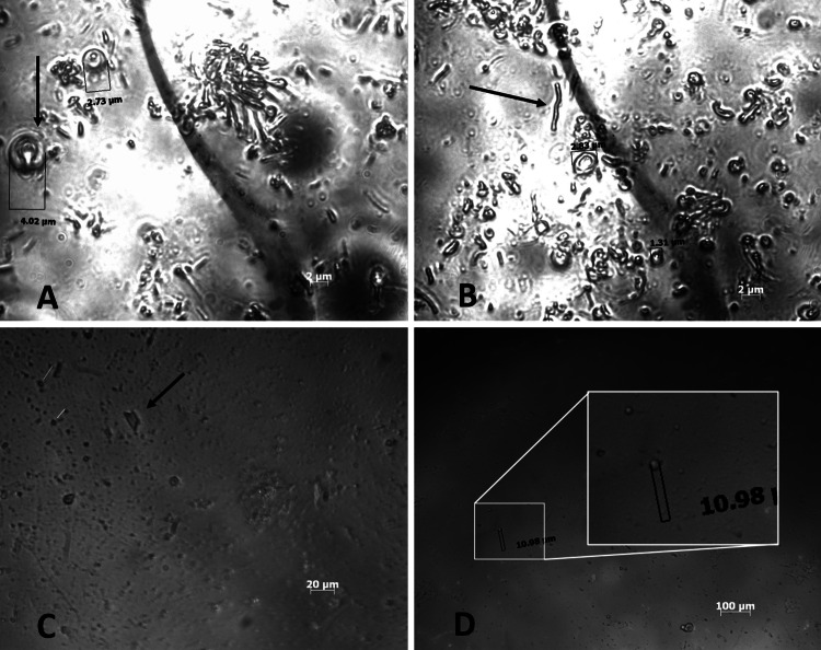 Evaluation of sonication on stability-indicating properties of optimized pilocarpine hydrochloride-loaded niosomes in ocular drug delivery.