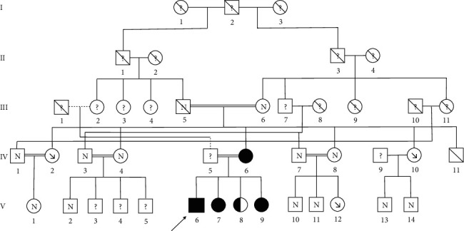 Mutation in the <i>SLC2A9</i> Gene: A New Family with Familial Renal Hypouricemia Type 2.