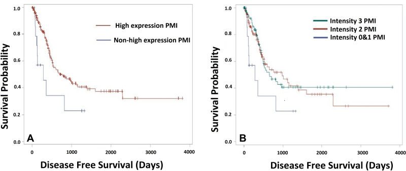 Phosphomannose Isomerase High Expression Associated with Better Prognosis in Pancreatic Ductal Adenocarcinoma.