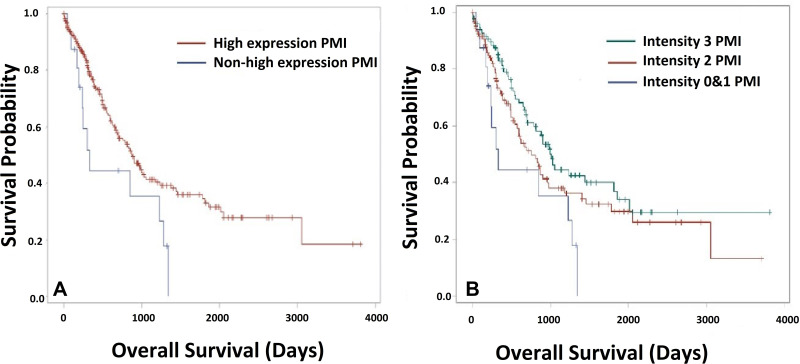 Phosphomannose Isomerase High Expression Associated with Better Prognosis in Pancreatic Ductal Adenocarcinoma.