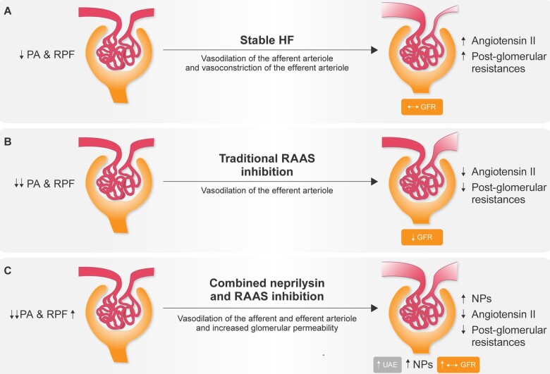Renal protection in chronic heart failure: focus on sacubitril/valsartan.