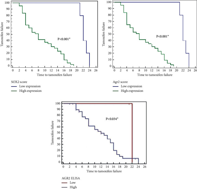 The Utility of SOX2 and AGR2 Biomarkers as Early Predictors of Tamoxifen Resistance in ER-Positive Breast Cancer Patients.