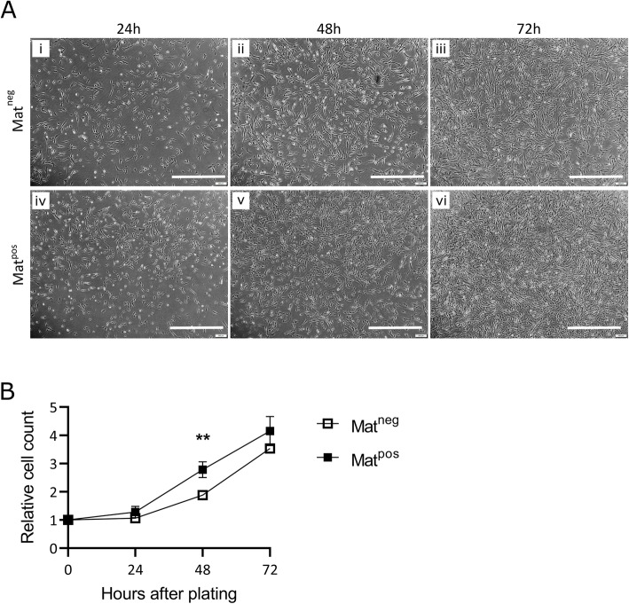 Improved CRISPR/Cas9 gene editing in primary human myoblasts using low confluency cultures on Matrigel.