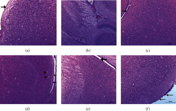 Nanonaringenin and Vitamin E Ameliorate Some Behavioral, Biochemical, and Brain Tissue Alterations Induced by Nicotine in Rats.