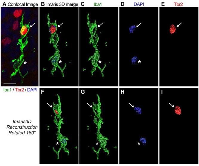 Greater Number of Microglia in Telencephalic Proliferative Zones of Human and Nonhuman Primate Compared with Other Vertebrate Species.