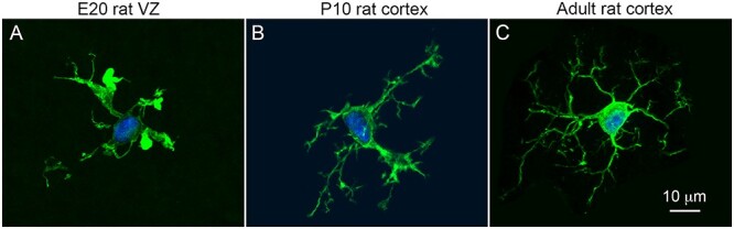 Greater Number of Microglia in Telencephalic Proliferative Zones of Human and Nonhuman Primate Compared with Other Vertebrate Species.