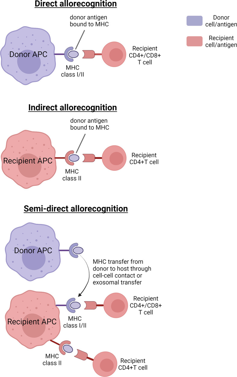 The immunogenicity of midbrain dopaminergic neurons and the implications for neural grafting trials in Parkinson's disease.