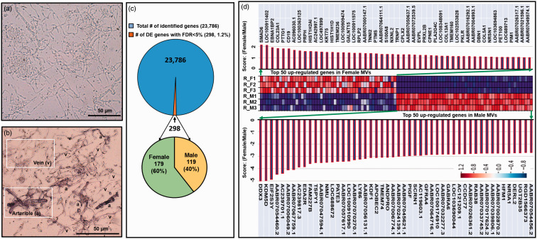 Transcriptome analysis reveals sexual disparities in gene expression in rat brain microvessels.