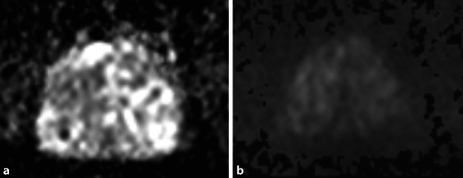 [PI-RADS 2.1 and structured reporting of magnetic resonance imaging of the prostate].