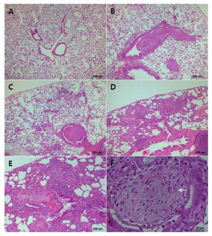 Histopathological changes in the lungs of rats instilled with Korean chrysotile.