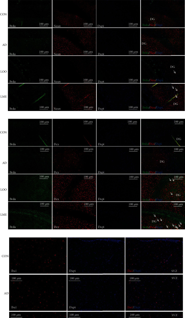 Lycopene-Loaded Microemulsion Regulates Neurogenesis in Rats with A<i>β</i>-Induced Alzheimer's Disease Rats Based on the Wnt/<i>β</i>-catenin Pathway.