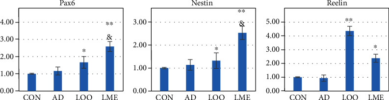 Lycopene-Loaded Microemulsion Regulates Neurogenesis in Rats with A<i>β</i>-Induced Alzheimer's Disease Rats Based on the Wnt/<i>β</i>-catenin Pathway.