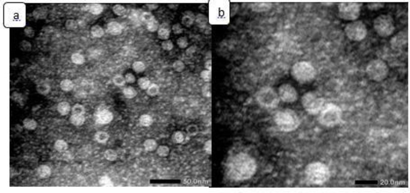 GENERATING RESPONSES IMMUNE IN CELLULAR AND HUMORAL TREATMENT WITH EPITOPE SPIKE, EPITOPE ENVELOPE PROTEIN, AND EPITOPE MEMBRANE PROTEIN SARS-COV-2, HONEY, <i>SAUSSUREA LAPPA</i>, AND <i>NIGELLA SATIVA</i>.