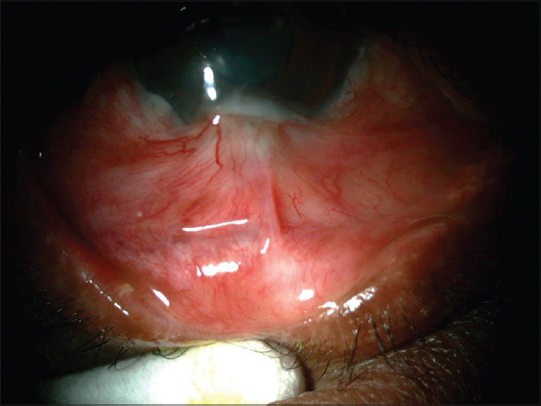 Ocular Complications Resulting from the Use of Traditional Herbal Medicine in Central Saudi Arabia: A Review.