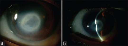 Ocular Complications Resulting from the Use of Traditional Herbal Medicine in Central Saudi Arabia: A Review.