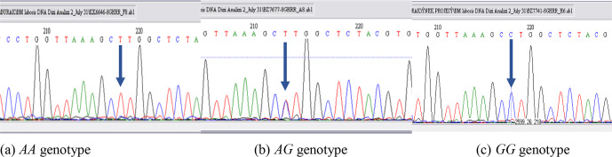 Determination of the association of <i>GHR</i>/<i>AluI</i> gene polymorphisms with milk yield traits in Holstein and Jersey cattle raised in Turkey.