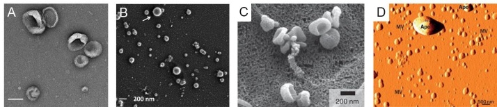 Erratum: Isolation and analysis methods of extracellular vesicles (EVs).