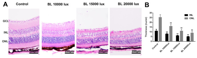 PET imaging of retinal inflammation in mice exposed to blue light using [<sup>18</sup>F]-DPA-714.