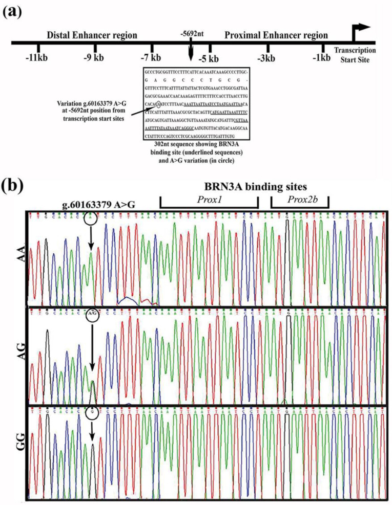 Novel Variant Identified in the Enhancer Region of Host Transcription Factor, BRN3A, is a Significant Risk Factor for HPV-Induced Uterine Cervix Cancer.