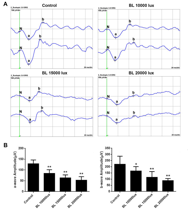 PET imaging of retinal inflammation in mice exposed to blue light using [<sup>18</sup>F]-DPA-714.