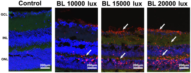 PET imaging of retinal inflammation in mice exposed to blue light using [<sup>18</sup>F]-DPA-714.