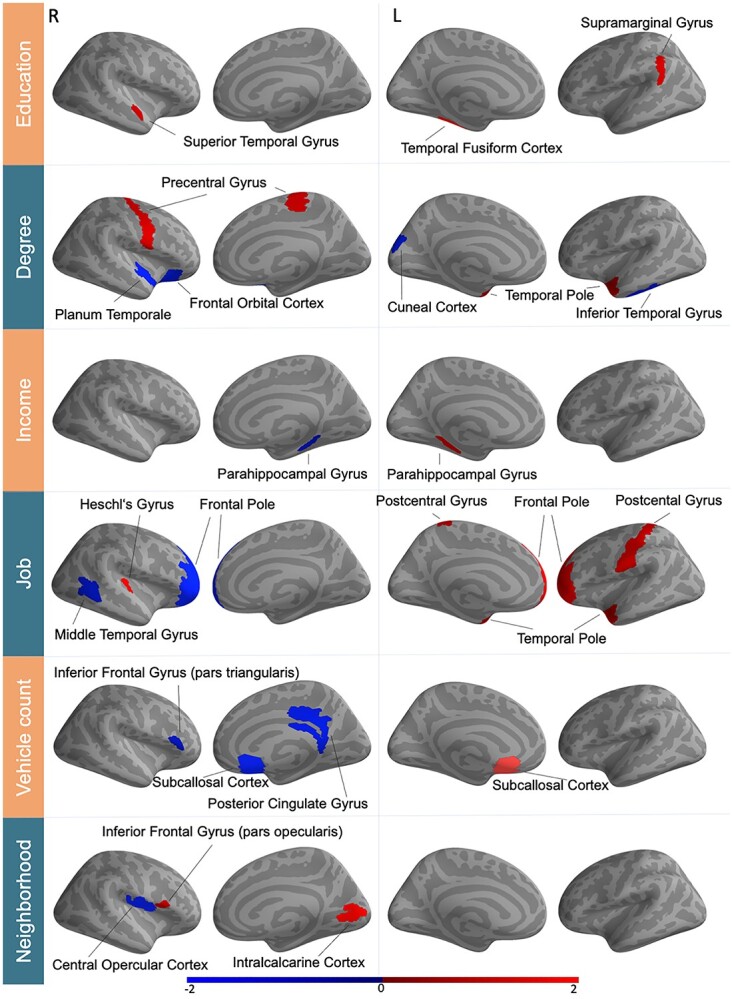 Pattern learning reveals brain asymmetry to be linked to socioeconomic status.