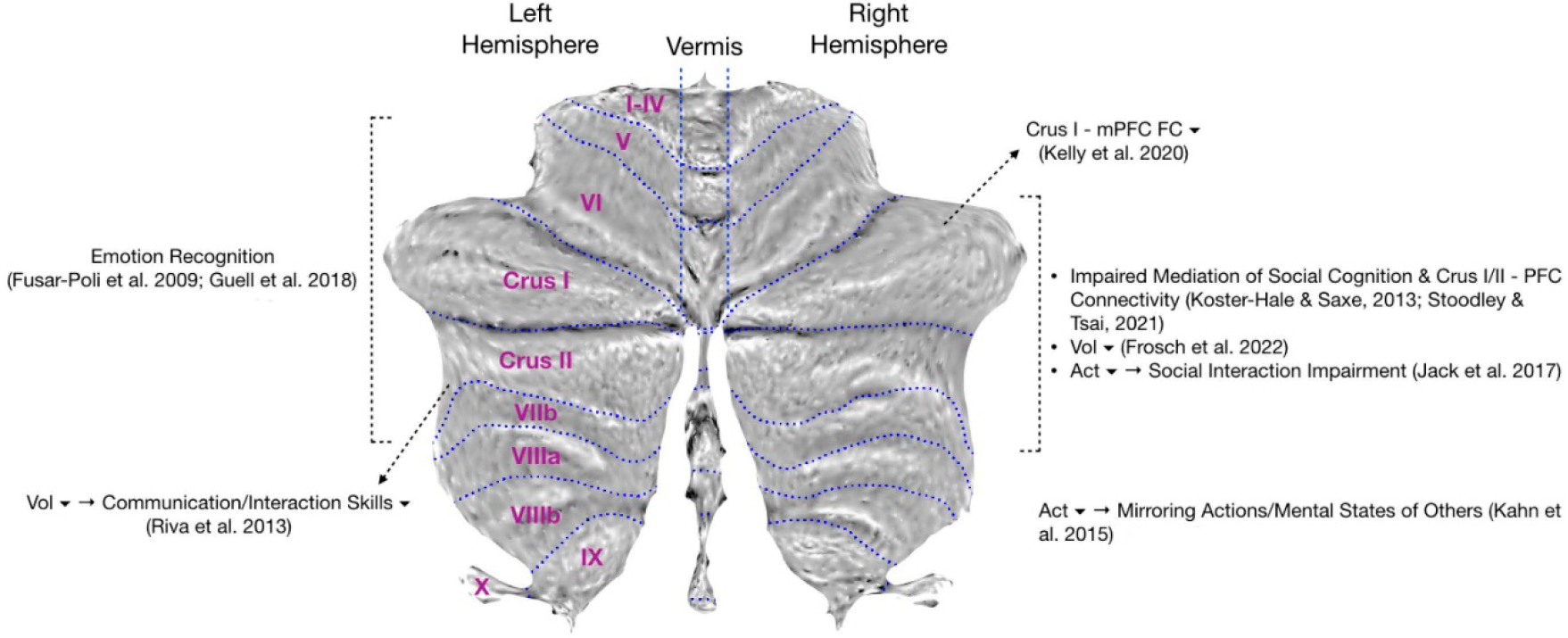 Cerebellar Structure and Function in Autism Spectrum Disorder.