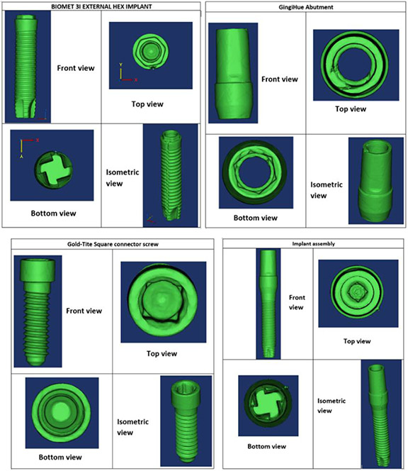 Effect of Bone Remodeling on Dental Implant Fatigue Limit Predicted Using 3D Finite Element Analysis.