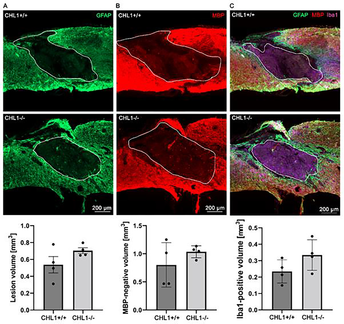 CHL1-Deficient and Wild-Type Male Mice do Not Differ in Locomotor Recovery from Spinal Cord Injury.