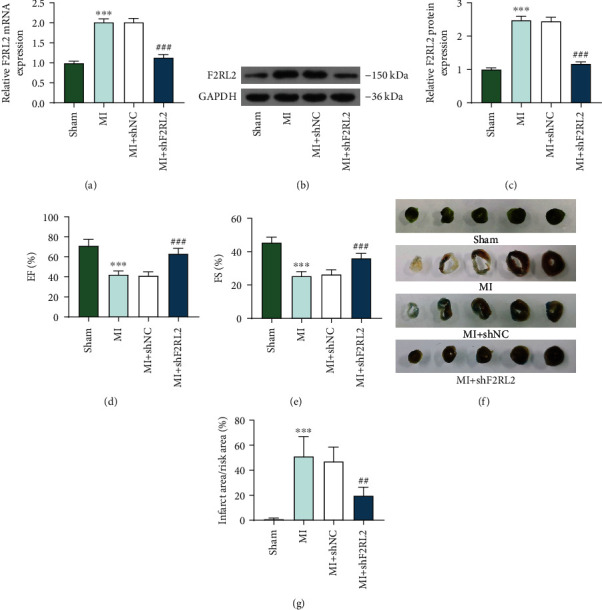 lncRNA NEAT1 Downregulation Ameliorates the Myocardial Infarction of Mice by Regulating the miR-582-5p/F2RL2 Axis.