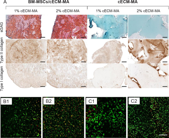 Three-dimensional bio-printing of decellularized extracellular matrix-based bio-inks for cartilage regeneration: a systematic review.