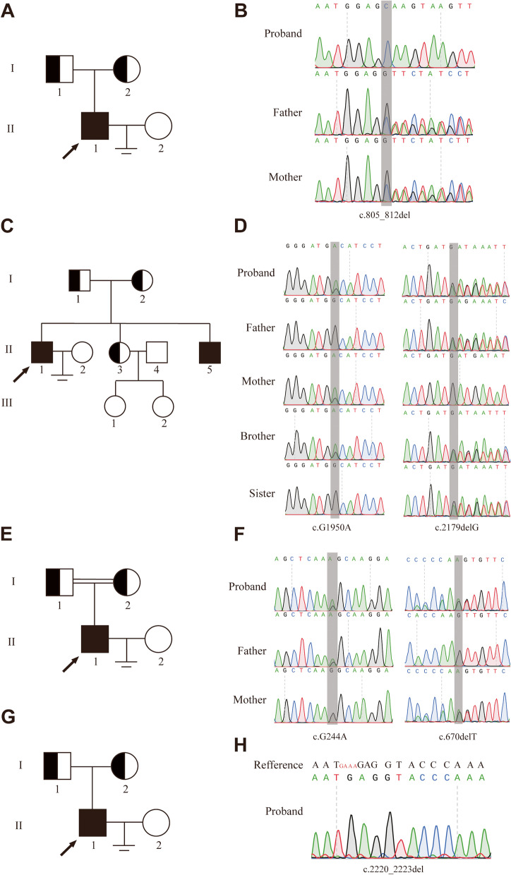 Novel bi-allelic MSH4 variants causes meiotic arrest and non-obstructive azoospermia.