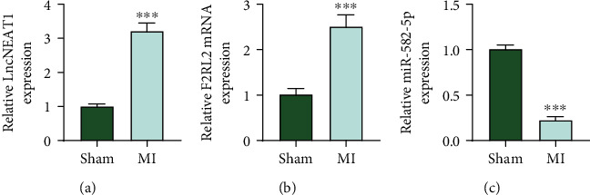 lncRNA NEAT1 Downregulation Ameliorates the Myocardial Infarction of Mice by Regulating the miR-582-5p/F2RL2 Axis.