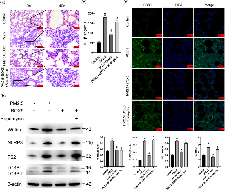 PM2.5 activated NLRP3 inflammasome and IL-1β release in MH-S cells by facilitating autophagy via activating Wnt5a.