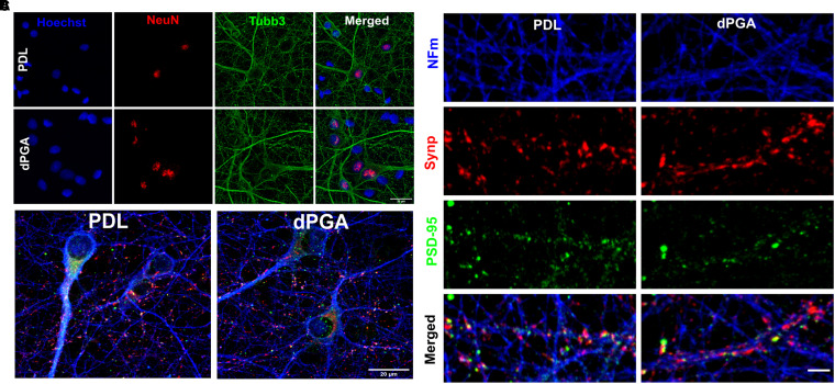 Dendritic Polyglycerol Amine: An Enhanced Substrate to Support Long-Term Neural Cell Culture.