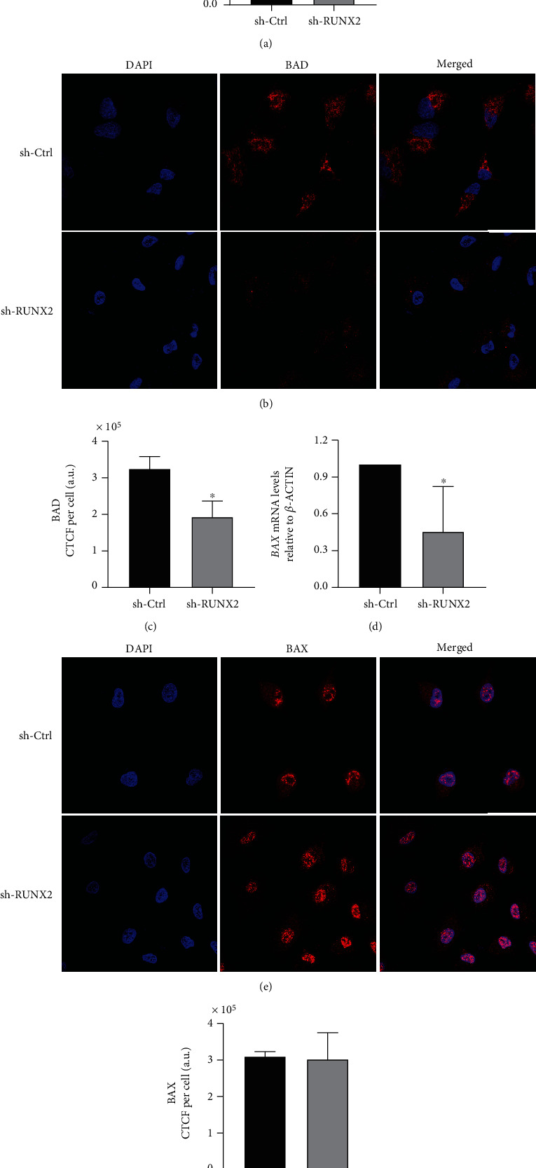 Regulatory Role of the RUNX2 Transcription Factor in Lung Cancer Apoptosis.