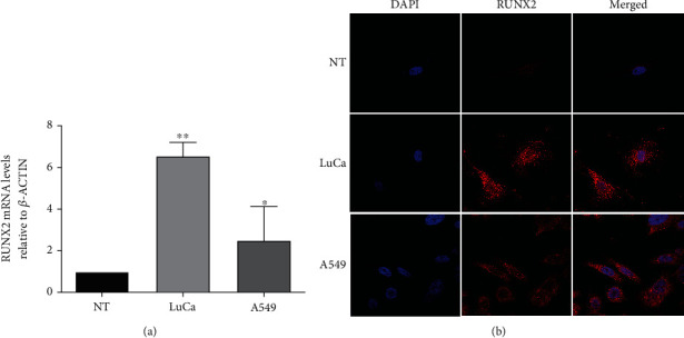 Regulatory Role of the RUNX2 Transcription Factor in Lung Cancer Apoptosis.